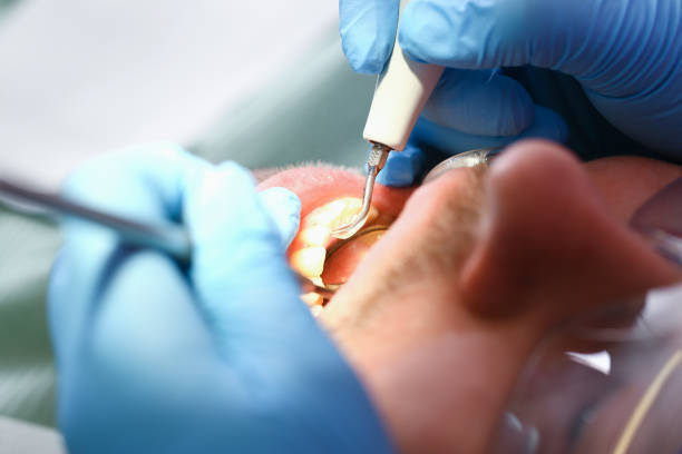 Best Cracked Tooth Emergency Dentist  in Dallas, TX